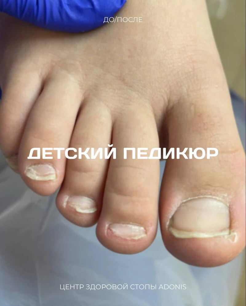 Центр здоровой стопы ADONIS
