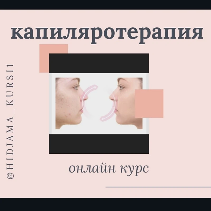 Капиляротерапия