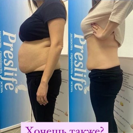 Прессотерапия 