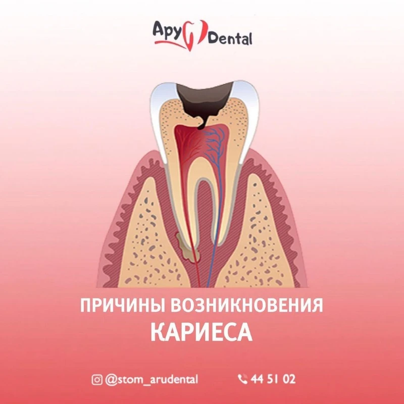 Стомотологии в Актобе. Ару Дентал Актобе. Лечение удаление зубов в Актобе. Aru Dental Aktobe 