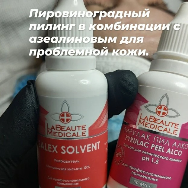 Пировиноградный пилинг для проблемной кожи.