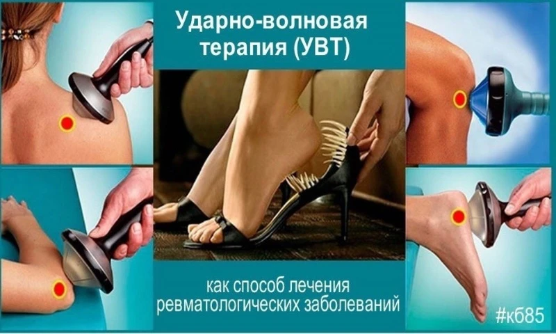Ударно-волновая терапия
