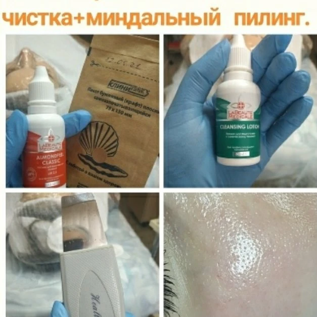 Комбинированная чистка+миндальный пилинг 1200р