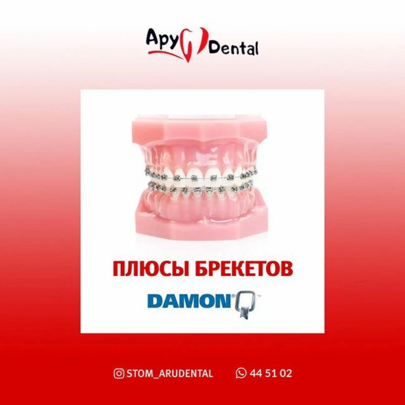 Ару дентал Актобе. Стомотологии в Актобе 
