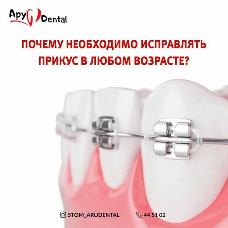 Ару дентал Актобе 