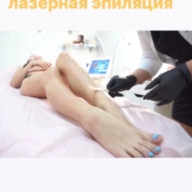 Лазерная эпиляция , диодный Лазер , депиляция