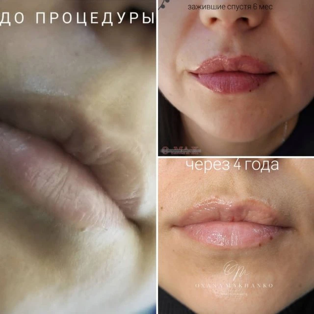 Как уходит татуаж? 