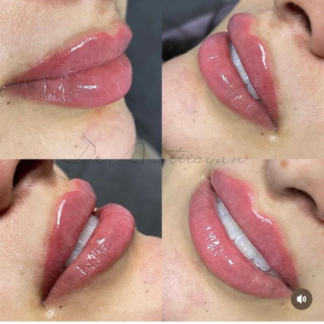 Успей попасть доктор М.Аветисян прием с 27-30 января 