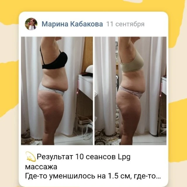 LPG массаж Адлер 
