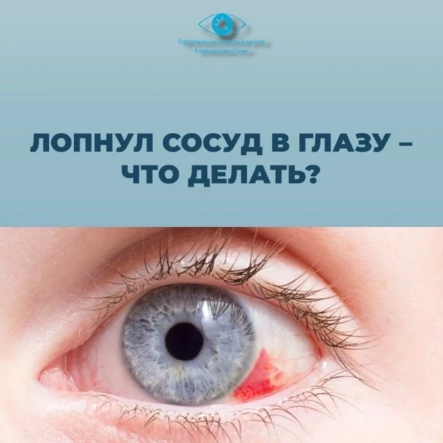 Лопнул сосуд в глазу, что делать? 