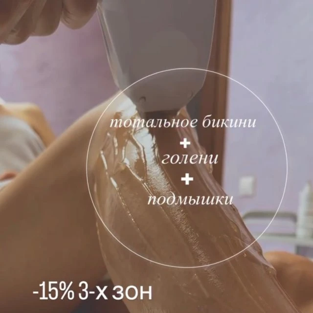 Лазерная эпиляция на аппарате Estetica 2.0