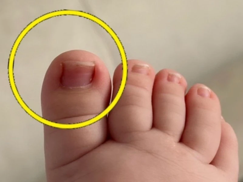 История одного лялепупса👶 