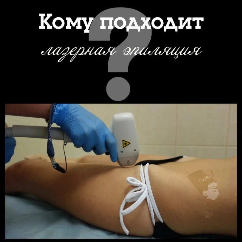 Лазерная эпиляция: кому подходит и зачем выбирать именно её?