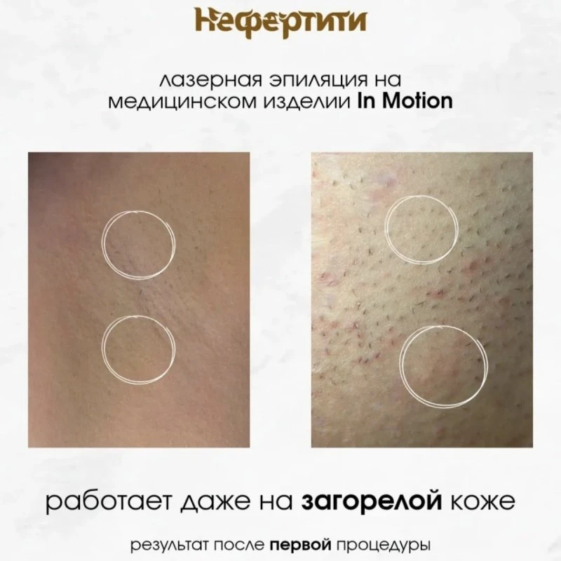  Совершенство – это естественно! 