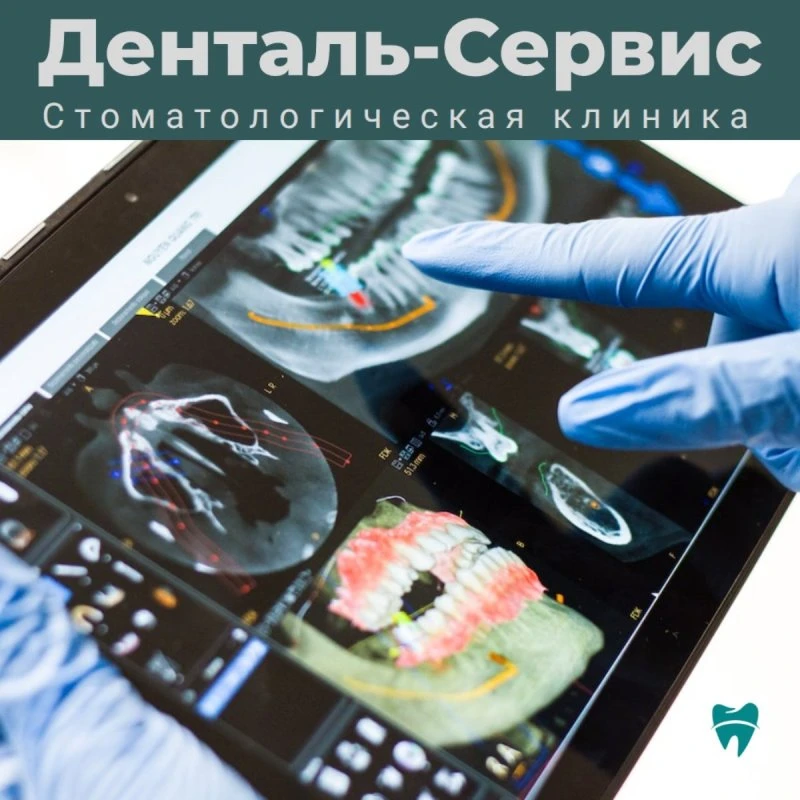 Срочная стоматологическая помощь в Сочи: что делать при острой боли?