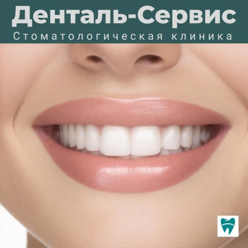 Голливудская улыбка за один визит: всё об установке виниров
