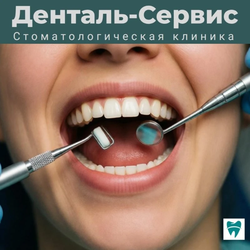 Профессиональная чистка зубов: зачем она нужна, если я чищу зубы дома?