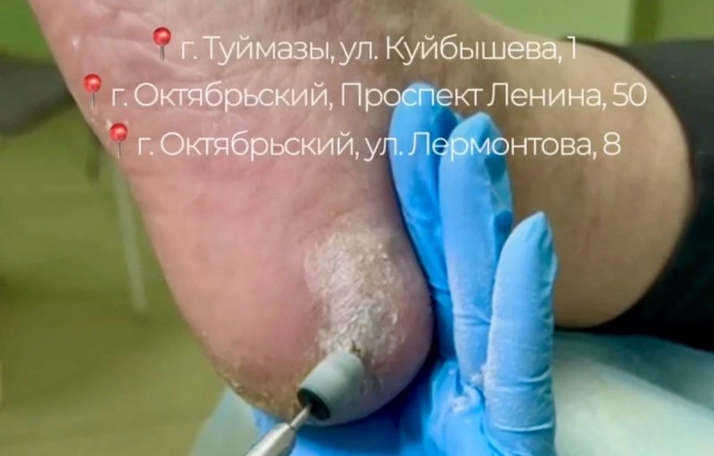Акция «Ножки- босоножки»